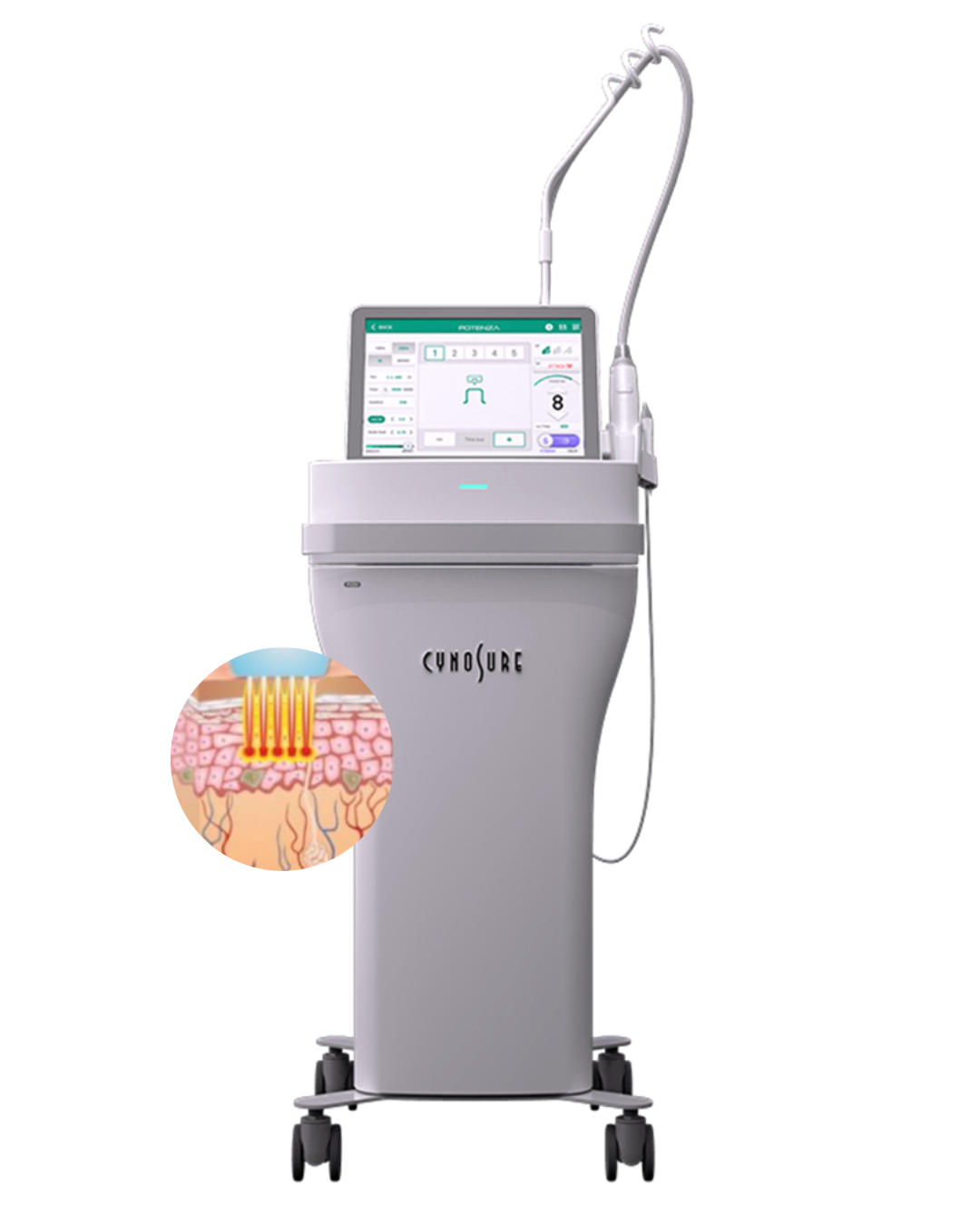 Ultherapy Prime